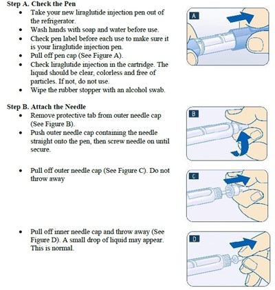 Step A-B.jpg stepa-b - Step A B